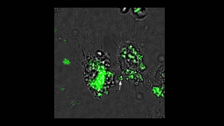 Avances en la lucha contra la brucelosis