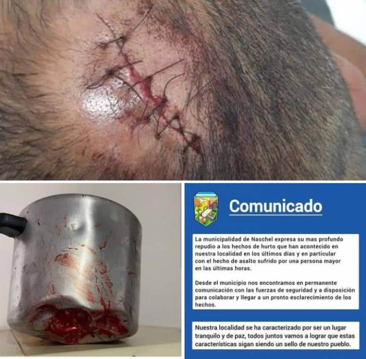 El norte si tiñe de inseguridad.Casi matan dos jubiladas en Naschel y Concarán.El Ministerio de Seguridad sin plan . La autopista Ruta 7 sin luz . En Mercedes lo mismo a tres cuadras de una Comisaría 